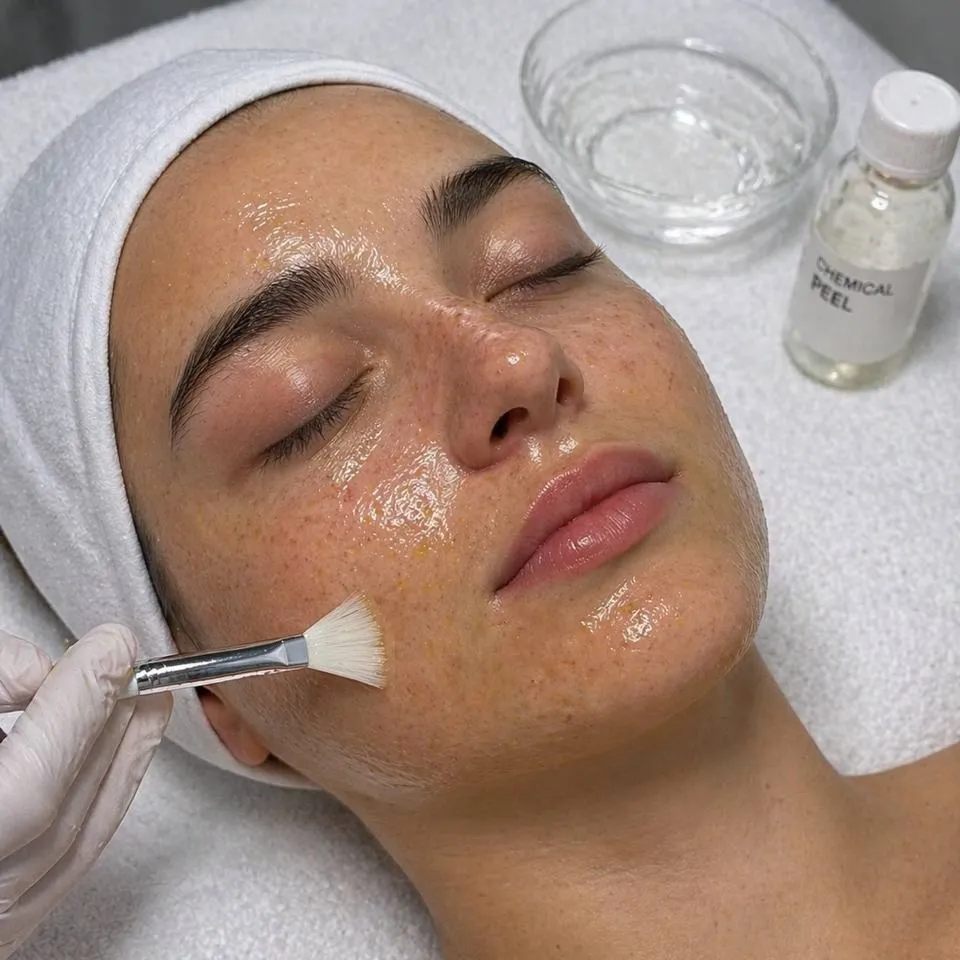 A chemical peel solution being brushed onto the face beside a glass dish