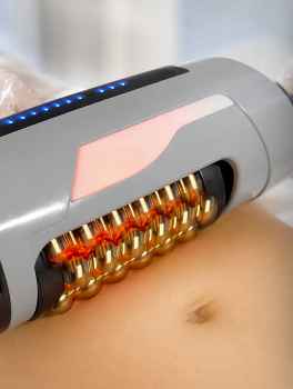 Endosphere body contouring at La Vilna